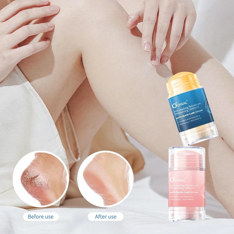 Crema antiagrietamiento para p - Heels reseña y precio